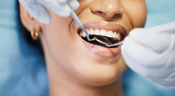 Best Emergency Dentist for Lost Fillings or Crowns in Horace, ND